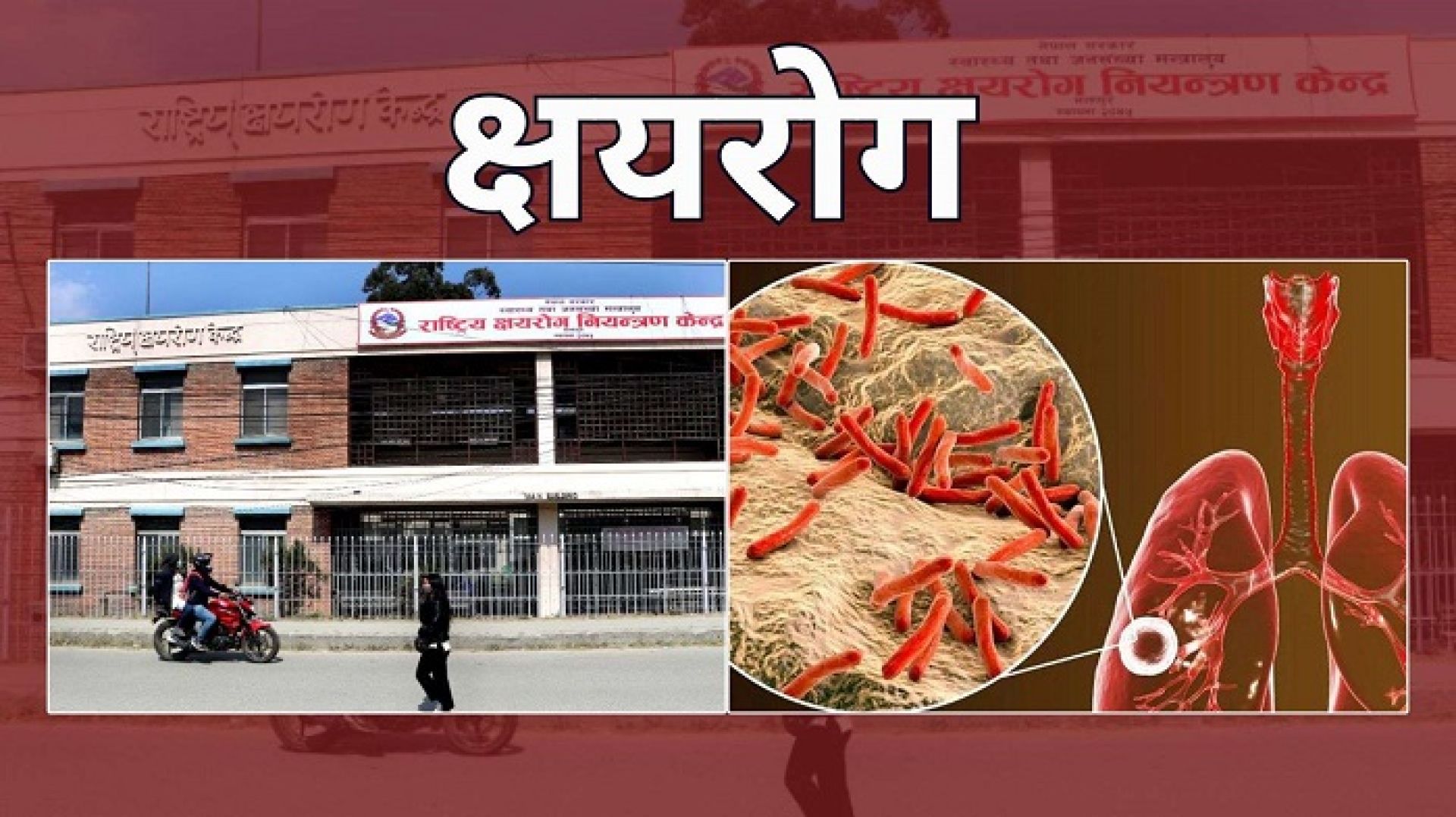 नेपालमा ६८ हजार नयाँ क्षयरोगी, २७ हजार भन्दा बढी छैनन् उपचारको पहुँचमा 